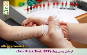 آزمایش های رایج خونی و پوستی برای تشخیص بیماری های آلرژیک ۳-شبکه جامع آلرژی
