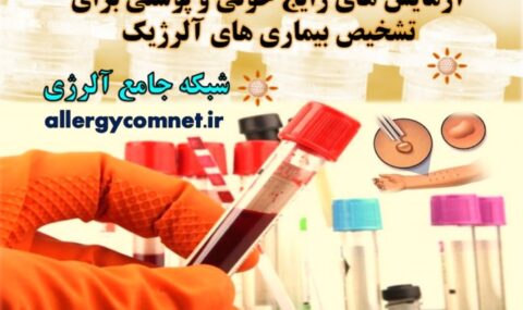 آزمایش-های-رایج-خونی-و-پوستی-برای-تشخیص-بیماری-های-آلرژیک-شبکه-جامع-آلرژی