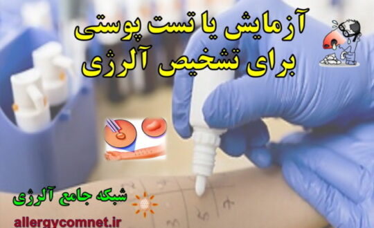 آزمایش-یا-تست-پوستی-برای-تشخیص-آلرژی-شبکه-جامع-آلرژی