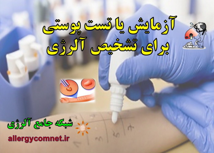 آزمایش-یا-تست-پوستی-برای-تشخیص-آلرژی-شبکه-جامع-آلرژی