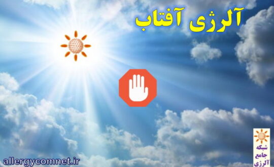 آلرژی-آفتاب-شبکه-جامع-آلرژی