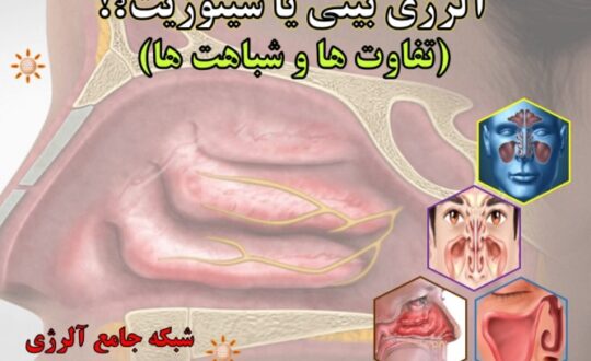 آلرژی-بینی-رینیت-آلرژیک-یا-سینوزیت-آلرژینو