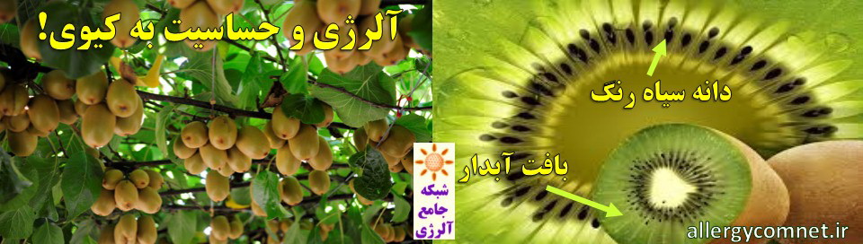 آلرژی و حساسیت به میوه کیوی ۳--شبکه جامع آلرژی