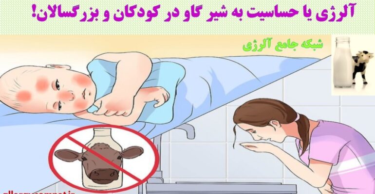 آلرژی-یا-حساسیت-به-شیر-گاو-در-کودکان-و-بزرگسالان