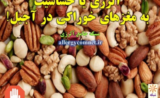 آلرژی-یا-حساسیت-به-مغزهای-خوراکی-در-آجیل