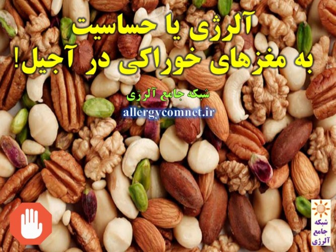 آلرژی-یا-حساسیت-به-مغزهای-خوراکی-در-آجیل