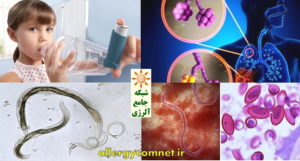 اثر ابتلا به عفونت های انگلی کرمی بر کاهش ابتلا به بیماری های آلرژیک ۱-شبکه جامع آلرژی