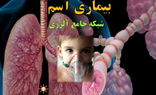 بیماری-آسم-شبکه-جامع-آلرژی-2