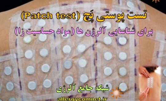 تست-پوستی-پَچ-برای-شناسایی-مواد-حساسیت-زا-یا-آلرژن-ها- آلرژینو