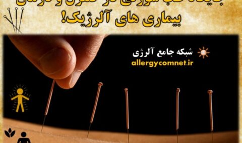 جایگاه-طب-سوزنی-در-کنترل-و-درمان-بیماری-های-آلرژیک-1- آلژینو