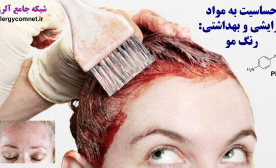 حساسیت-به-مواد-آرایشی-و-بهداشتی-رنگ-مو