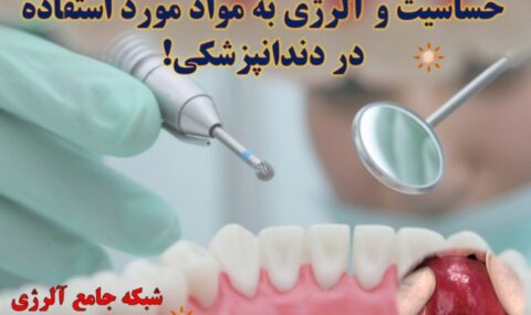 حساسیت-و-آلرژی-به-مواد-مورد-استفاده-در-دندانپزشکی- آلژینو