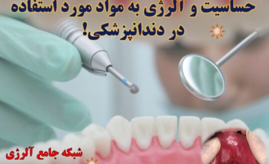 حساسیت-و-آلرژی-به-مواد-مورد-استفاده-در-دندانپزشکی- آلژینو