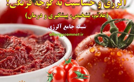 حساسیت-و-آلرژی-به-گوجه-فرنگی- آلژینو