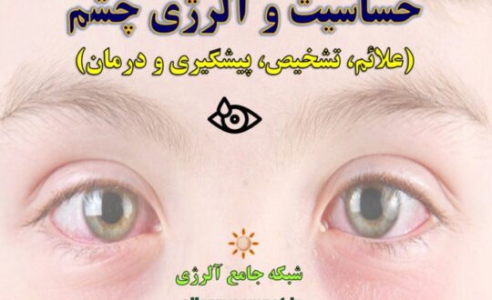حساسیت-و-آلرژی-چشم- آلرژینو