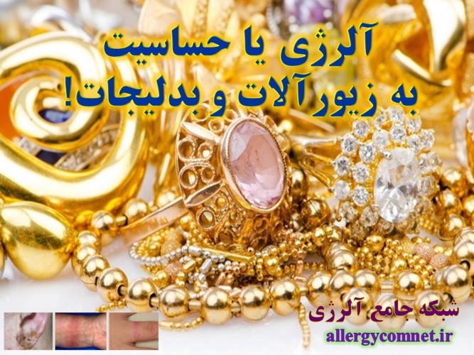 حساسیت-یا-آلرژی-به-زیورآلات-و-بدلیجات-2