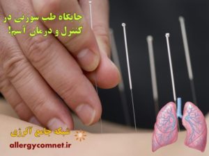 طب سوزنی در کنترل و درمان بیماری های آلرژیک 3 شبکه جامع آلرژی e1531906279344 300x225 1